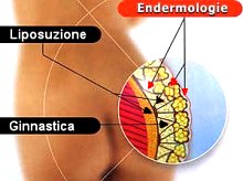 Lipomassage Endermologie LPG Milano